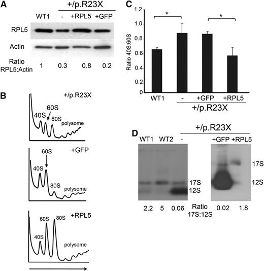 Figure 6. RPL5+/p.R23X iPSCs exhibit ribosomal defects that are rescued by gene correction. (A) Western blot for RPL5 protein in WT1 and RPL5+/p.R23X iPSCs (first 2 lanes). Gene-corrected and control sublines were generated by introducing WT RPL5 or GFP cDNA, respectively, into the AAVS1 locus of RPL5+/p.R23X iPSCs (lanes 3 and 4). Ratio of RPL5:actin analyzed by densitometry is shown relative to the WT1 clone, which is assigned an arbitrary value of 1.0. (B) Polysome profiling of RPL5+/p.R23X iPSCs and sublines with GFP or WT RPL5 cDNAs integrated into the AAVS1 locus. A polysome profile of a WT iPSC line is shown in Figure 1B. Arrow shows direction of the sucrose gradient from less to more dense. (C) Summary of 3 polysome profiling experiments showing increased ratio of 40S:60S ribosomal subunits in RPL5-haploinsufficient iPSCs (lanes 2 and 3), compared with WT (lane 1) or RPL5-rescued RPL5+/p.R23X iPSCs (lane 4). *P < .05. (D) Northern blot analysis with the ITS2 probes (see Figure 1D) showing accumulation of 12S pre-rRNA molecules in RPL5+/p.R23X iPSCs (designated as “–” in the last lane of the left panel) compared with WT cells. This defect is ameliorated in RPL5+/p.R23X iPSCs expressing WT RPL5 cDNA, but not in those expressing GFP cDNA (right). The ratios of 17S:12S rRNAs determined by densitometry scanning are shown at the bottom.