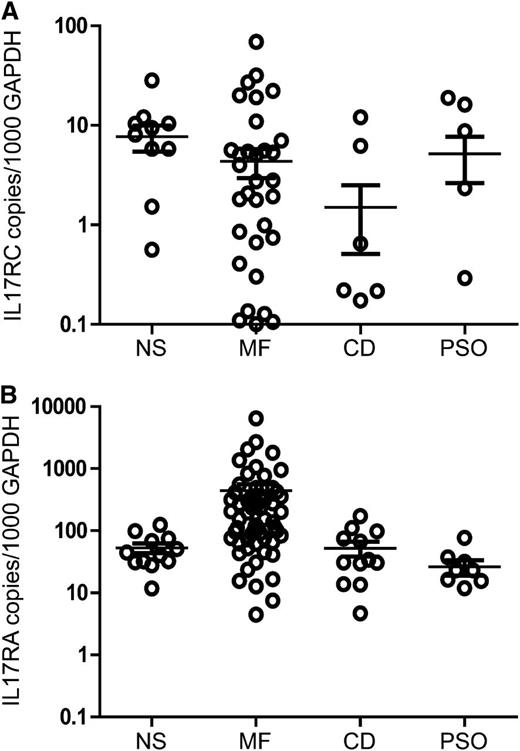 Figure 4. Quantification of IL-17RC and IL-17RA mRNA in MF and benign skin biopsies. Skin biopsies from individuals with MF, chronic dermatitis (CD), psoriasis (PSO), and normal healthy skin (NS) were analyzed by QPCR using primers specific to IL-17RC, IL-17RA, and GAPDH mRNA. The expression of IL-17RC and IL-17RA was normalized to GAPDH, so that the levels shown represent copies of (A) IL-17RC or (B) IL-17RA mRNA per 1000 copies of GAPDH mRNA. Bars denote the average and standard deviation for each skin type analyzed.