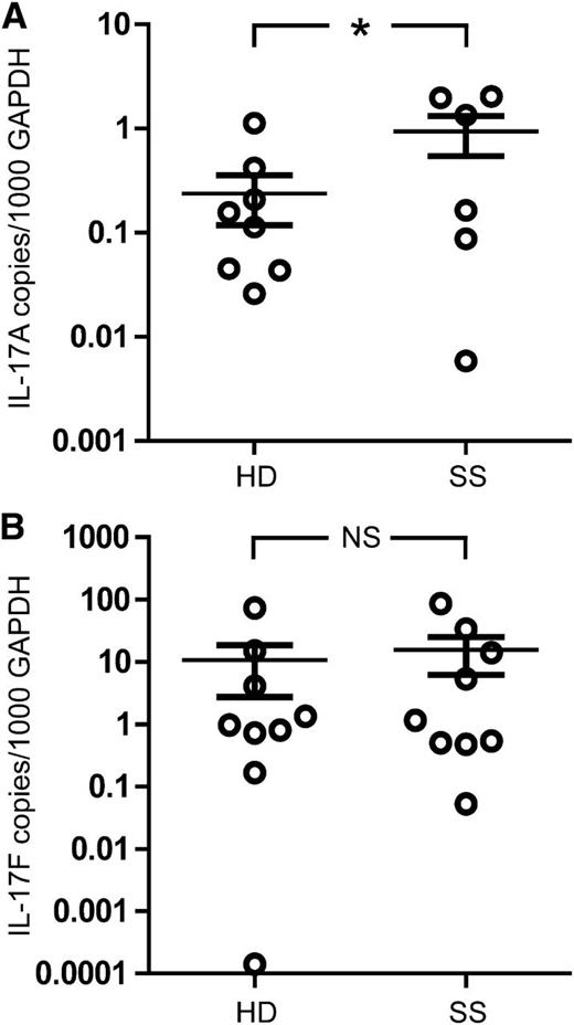 Figure 6. Quantification of IL-17F and IL-17A mRNA in CD4 T cells isolated from the blood of SS patients and healthy donors. RNA purified from CD4 T cells freshly isolated from the blood of healthy donors (HD) and patients with SS was subjected to QPCR using primers specific for (A) IL-17A and (B) IL-17F. The expression of IL-17A and IL-17F was normalized to GAPDH, so that the level shown represents copies of IL-17A or IL-17F mRNA per 1000 copies of GAPDH mRNA. Bars denote the average and standard deviation for each skin type analyzed. *Indicates a statistically significant difference (P < .05), whereas NS indicates no significant difference (P > .05).