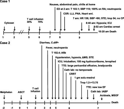 Figure 1. Timeline of events after infusion of engineered T cells. ΔMS, altered mental status; Afib, atrial fibrillation; ASCT, autologous stem cell transplant; Cath laboratory, cardiac catheterization laboratory; CP, chest pain; CRRT, continuous renal replacement therapy; CXR, chest x-ray; ED, emergency department; EF, ejection fraction; HR, heart rate; IABP, intra-aortic balloon pump; ICU, intensive care unit (transfer); LLL, left lower lobe; MSOF, multisystem organ failure; PNA, pneumonia; RA, room air; SBP, systolic blood pressure; STE, ST elevations on electrocardiogram; T, temperature; Trop, troponin; TTE, transthoracic echocardiogram; Wnl, within normal limits. 100% on RA, 100% oxygen saturation on room air by pulse oximetry.
