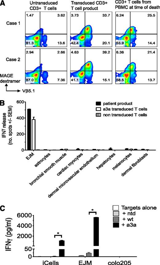 Figure 5. Elucidation of mechanism of clinical cardiac toxicity. (A) Analysis for expression of the correctly paired MAGE-A3–engineered TCR (MAGE dextramer staining, y-axis) of input (untransduced) T cells, transduced T-cell product, and T cells recovered from PBMCs in both patients at time of death. The x-axis shows staining for specific TCR-β chain (Vβ5.1) used by the engineered MAGE-A3 TCRs. Numbers shown in each quadrant indicate percentages of the gated CD3+ cells. Cell populations that stain only for Vβ5.1 but not dextramer are the sum of (1) endogenous TCR that uses that β chain (ie, population shown in input T cells) and (2) mispaired MAGE-A3–engineered TCR. No expansion of T cells with mispaired TCRs was detected after infusion in the patients. (B) A sample of the T-cell product infused into Case 2, along with fresh MAGE-A3a3a–transduced T cells and untransduced T cells, was tested for IFN-γ production by ELISPOT when cocultured with a large panel of HLA-A1+ cell lines, including one that was MAGE-A3+ (EJM) as a positive control. Bars indicate mean ± standard error of the mean (SEM) of 3 replicates. (C) Activation and cytokine production of MAGE-engineered T cells incubated in vitro with HLA-A*01+, titin-positive, MAGE-A3− beating cardiac myocyte cells derived from iPSC-CM or iCells. The EJM plasmacytoma cell line expresses HLA-A*01 and MAGE-A3 (positive control), and the colo205 cancer cell line expresses HLA-A*01 but not MAGE-A3 or titin (negative control). Controls for the effector cells are nontransduced (ntd) T cells, or no T cells (targets only). Bars indicate mean ± SEM of 3 replicates. *P < .0001 by Student t test.