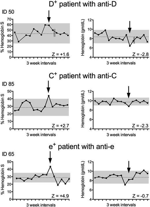 Figure 2. DTRs in patients with unexplained Rh antibodies. Percent hemoglobin S and hemoglobin levels in 3 representative cases of chronically transfused patients with anti-D, -C, and -e (see Table 2 for values of all DTRs associated with Rh antibodies). Each point represents a pretransfusion value coinciding with transfusions occurring at 3-week intervals. Arrows indicate time of antibody detection. The dotted line represents the mean percent hemoglobin S or hemoglobin level for that individual determined pretransfusion for 9 visits preceding antibody detection. The SD for means was calculated. The difference between the baseline and the value at time of antibody formation is expressed as a multiple of this SD, or Z-score. The gray shaded area indicates values that would have a Z-score <2. Z-score >2.0 for hemoglobin S level or <−2.0 for hemoglobin level correlates with P < .05. The double lines on the top charts indicate a several-month period when transfusions were discontinued.
