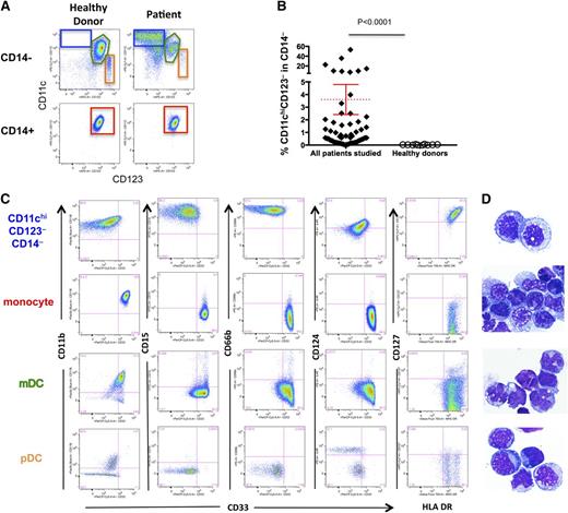 Figure 1. Expansion of a novel myeloid cell subset in cancer patients. (A) In cancer patients, gating on CD14– cells in monocyte-rich fractions elutriated from apheresis products showed expansion of CD11chiCD123– cells (blue box) that are not present in healthy donors. The green box denotes myeloid dendritic cells and the orange box denotes plasmacytoid dendritic cells. The CD14+ fraction is comprised entirely of monocytes (red box) in patients and healthy donors. (B) Percent of CD11c+CD123– cells in the patient cohort (n = 53) vs healthy donors (n = 10). The red dotted line represents the mean, and the error bar represents the SEM. (C) Expression profiles of gated subsets (color coded) are shown. CD11chiCD123–CD14– cells express common MDSC markers, including CD11b, CD15, CD66b, and CD124, but they also express HLA-DR and CD127. Quadrants set based on the background fluorescence using fluorescence minus one (FMO) controls. Representative flow cytometry plots from a representative subject are shown. (D) Hematoxylin and eosin–stained cytospins of electronically sorted subsets (original magnification ×200) from a representative subject. CD11chiCD123–CD14– cells resemble immature monocytes, whereas other subsets show the expected morphology.