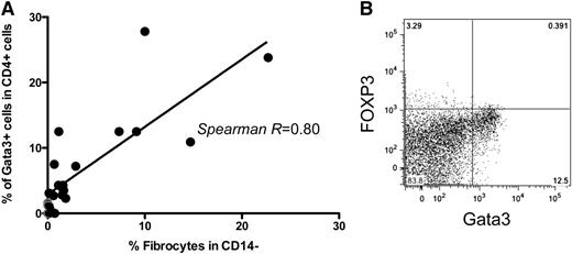 Figure 4. Frequency of circulating fibrocytes in cancer subjects correlates with the expansion of circulating GATA3+CD4+ T cells. (A) Correlation between % fibrocytes in the monocyte-rich apheresis fraction and GATA3+CD4+ T cells in the lymphocyte-rich apheresis fraction acquired simultaneously. Each closed dot represents a value measured in an individual subject from whom adequate simultaneous monocyte-rich and lymphocyte-rich samples were available (n = 22 subjects). Gray dots represent results from normal donors (P < .05). (B) Representative flow cytometry dot plot illustrating high levels of GATA3+CD4+ T cells from 1 subject with simultaneous fibrocyte expansion. CD4+ cells were analyzed immediately after thawing and permeabilization without stimulation.