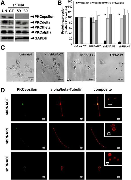 Figure 2. PKCε expression is necessary for proPLT formation. (A) Western blot detection of PKCε, PKCδ, PKC\x{03b8}θ, and PKCα in mouse MK untreated (UN) or infected with PKCε-specific shRNAs (shRNA59, shRNA60) and nontarget shRNACT. GAPDH was monitored for protein loading. (B) Densitometric analysis of PKC protein expression was performed using ImageJ software. Densitometric measurements of western blots from 3 replicates (means ± 1 SD; *P < .05 vs shRNACT ANOVA and Tukey tests). (C) Representative images of proplatelet-forming MK infected with PKCε-specific shRNAs (shRNA59, shRNA60) or control (shRNACT), isolated at day 4 by gradient and cultured for an additional 24 hours. (D) Immunofluorescence analyses of proplatelets from MK infected with PKCε-specific shRNA (shRNA59, shRNA60) and control (shRNACT), isolated at day 4 by gradient separation and cultured for a further 24 hours. Samples were labeled with specific antibodies against α/β-Tubulin and PKCε. The composite panels show the colocalization of PKCε and α/β-Tubulin at the tubular coil (particularly in released platelets, as shown in the insert) in shRNACT, and the abnormal morphology, in terms of dimension and tubular coil definition, of platelets released by PKCε-specific shRNA infected MKs. Samples were examined with microscope Axiovert 200 (Carl Zeiss, Inc., Thornwood, NY), equipped with a 63× numerical aperture 1.4 oil immersion objective. Images were obtained using a CCD camera and analyzed using the MetaMorph image analysis software. Images were obtained at 22°C and analyzed using ImageJ software. PKCε was detected with a rabbit polyclonal antibody and a secondary goat anti-rabbit antibody, conjugated to an Alexa Fluor 488; α and β tubulin were detected with rmouse monoclonal antibodies and a secondary goat anti-mouse antibody, conjugated to an Alexa Fluor 568.