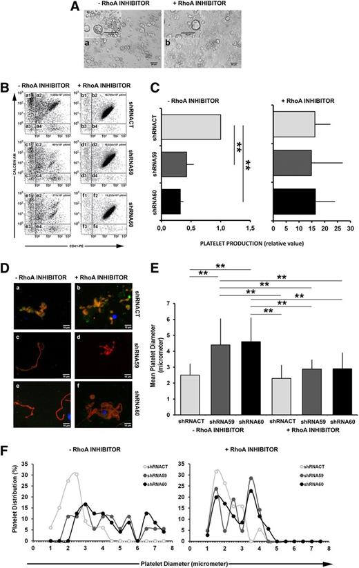Figure 4. RhoA inhibition restores proPLT formation and PLT release in MK infected with PKCε-specific shRNA. (A) Representative images of ppFMK in the absence or presence of RhoA pharmacological inhibitor. Cultures of cells treated with RhoA inhibitor presented increased quantities of proplatelets and released platelets. (B) Representative scatter plots of flow cytometric analyses of platelets released in culture. Fixed volumes of media from the different cultures were collected, labeled with CD41 and Calcein AM, and mixed with a fixed volume of calibration beads for absolute PLT count. Only cells CD41pos/Calcein AMpos were considered as preserved platelets (quadrants: a2, b2, c2, d2, e2, f2). The absolute count for each sample was reported inside the scatter plots. In the absence of RhoA inhibitor, the cells treated with PKCε-specific shRNA59 (c2) and shRNA60 (e2) released fewer platelets than did control (shRNACT; a2). In the presence of RhoA inhibitor, both control (shRNACT; b2) and PKCε-specific shRNA (shRNA59 and shRNA60; d2 and f2) samples released around 20-fold more platelets. (C) Analysis of PLT production. Data, from 4 replicates, are normalized for shRNACT (means ± 1 SD; **P < .01 ANOVA and Tukey tests). (D) Immunofluorescence analyses of proplatelets, labeled with specific antibodies against PKCε (green) and α/β-Tubulin (red), in the absence (a, c, e) or presence of RhoA inhibitor (b, d, f). In comparison with the control (shRNACT; a), proplatelets derived from PKCε-specific shRNAs infected MK (shRNA59 and shRNA60; c and e) were aberrant and lacking the typical spherical organization of PLT precursors. In the presence of the RhoA inhibitor, the shRNAs infected MK (shRNA59 and shRNA60; d and f) produced proplatelets with a morphology similar to the control (shRNACT; b). Samples were examined with microscope Axiovert 200 equipped with a 63× numerical aperture 1.4 oil immersion objective. Images were obtained using a CCD camera and analyzed using the MetaMorph image analysis software. Images were obtained at 22°C. PKCε was detected with a rabbit polyclonal antibody and a secondary goat anti-rabbit antibody, conjugated to an Alexa Fluor 488; α and β tubulin were detected with rmouse monoclonal antibodies and a secondary goat anti-mouse antibody, conjugated to an Alexa Fluor 568. (E) Analysis of PLT dimensions (means ± 1 SD; **P < .01 ANOVA and Tukey tests). For each group, several platelets were analyzed from different fields. In the absence of RhoA inhibitor the platelet counts were (1) shRNACT, 33 PLTs; (2) shRNA59, 18 PLTs; and (3) shRNA60, 23 PLTs. In the presence of RhoA inhibitor, they were (1) shRNACT, 19 PLTs; (2) shRNA59, 21 PLTs; and (3) shRNA60, 35 PLTs. The mean cell diameter was calculated with MetaMorph and Image J software. (F) Analysis of size distribution within PLT populations.
