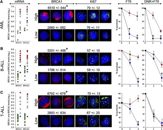 Figure 6. F79 aptamer exerts synthetic lethality in acute leukemias displaying epigenetic BRCA-deficient phenotype. (A) AML (n = 15), (B) BCR-ABL1 -negative B-ALL (n = 18), and (C) T-ALL (n = 10) xenograft cells and CD34+ (n = 3), B-cells (n = 11) and T-cells (n = 17) from healthy donors were employed here. (mRNA) Microarray detection of mRNA for BRCA1 and BRCA2; each circle represents an individual patient; BRCA1 and/or BRCA2 high (red) and low (blue) samples were used for further studies. Green circles represent cells from healthy donors. (BRCA1 and Ki67) Immunofluorescent quantitation of BRCA1 protein levels in Ki67-positive cells and percentage of Ki67-positive cells. Representative cells highlighting the differences of BRCA1 (red) levels in Ki67-positive cells (green) are shown; nuclei are counterstained with 4,6 diamidino-2-phenylindole. (F79) Xenograft cells were incubated in vitro with 5 μM F79 aptamer. (DNR+F79) Xenograft cells were treated in vitro with daunorubicin (0.2 μM for AML, 0.1 μM for B-ALL and T-ALL) and 5 μM F79 aptamer. Results represent percentage of surviving cells; *P < .05 in comparison with BRCAhigh patients.