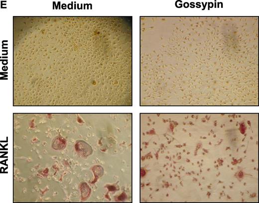 Figure 6. Gossypin inhibits TNF-induced invasion and RANKL-induced osteoclastogenesis. (A) Gossypin suppressed TNF-induced invasion. H1299 cells were seeded in the top of a Matrigel invasion chamber overnight in the absence of serum, preincubated with 50 μM gossypin for 2 hours, treated with 1 nmol/LTNF for 24 hours in the presence of 1% serum, and then subjected to an invasion assay, as described in “Materials and methods.” (B and C) Gossypin inhibited RANKL-induced osteoclastogenesis. RAW 264.7 cells were incubated alone or with RANKL (5 nmol/L), with or without 50 μM gossypin, for 5 days and stained for TRAP expression. (B,D) Multinucleated (three nuclei) osteoclasts were counted. (C) TRAP-positive cells were photographed (10× 0.25 objective, TMS, Nikon, Tokyo, Japan; Coolpix 950 color camera, Nikon, Lewisville, TX). Original magnification, ×100. (D-E) Gossypin inhibited RANKL-induced osteoclastogenesis. Mouse (C57BL/6J) primary bone marrow cells were incubated alone or with RANKL (5 nmol/L), with or without 50 μM gossypin, for 3 days and stained for TRAP expression. (D) Multinucleated (three nuclei) osteoclasts were counted. (E) TRAP-positive cells were photographed. Original magnification, ×100.