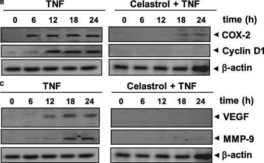 Figure 2. Celastrol inhibits TNF-induced NF-κB–regulated gene products. (A) Celastrol inhibits the expression of antiapoptotic gene products such as survivin, IAP1, IAP2, Bcl-XL, Bcl-2, and c-FLIP. KBM-5 cells (2 × 106 /mL) were left untreated or were incubated with 2.5 μM celastrol for 6 hours and then treated with 1 nM TNF for different amounts of time. Whole-cell extracts were prepared, and 30 μg of the whole-cell lysate was analyzed by Western blotting using antibodies against IAP1, IAP2, Bcl-xl, Bcl-2, cFLIP, and survivin as indicated. (B) Celastrol inhibits COX-2 and cyclin D1 expression induced by TNF. KBM-5 cells (2 × 106/mL) were left untreated or were incubated with 2.5 μM celastrol for 6 hours and then treated with 1 nM TNF for different times. Whole-cell extracts were prepared, and 30 μg of the whole-cell lysate was analyzed by Western blot analysis using antibodies against COX-2 and cyclin D1. (C) Celastrol inhibits VEGF and MMP-9 expression induced by TNF. KBM-5 cells (2 × 106 mL) were left untreated or were incubated with 2.5 μM celastrol for 6 hours and then treated with 1 nM TNF for different times. Whole-cell extracts were prepared, and 30 μg of the whole-cell lysate was analyzed by Western blot analysis using antibodies against MMP-9 and VEGF. Data are for a representative experiment of 3 independent experiments showing similar results.
