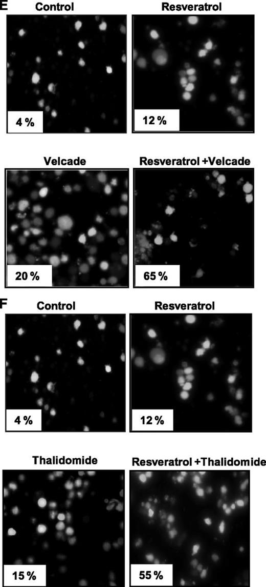 Figure 1. Resveratrol suppresses the proliferation of drug-resistant MM cell lines and potentiates the apoptotic effect of bortezomib and thalidomide. (A-D) U266 cells (5 × 103/100 μL; A), dexamethasone-sensitive (B, left) and dexamethasone-resistant (B, right) MM.1 cells (20 × 103/100 μL), doxorubicin-sensitive (C, left) and doxorubicin-resistant (C, right) RPMI 8266 cells (20 × 103/100 μL), and melphalan-sensitive (D, left) and melphalan-resistant (D, right) RPMI 8266 cells were plated in triplicate, treated with 50 μM resveratrol, and then subjected to MTT assay on days 2, 4, or 6 to analyze proliferation of cells. ○ represents control and ● represents resveratrol-treated cells. Each point on line is an average of triplicate value. Resveratrol induced inhibition of cell growth at days 2 and 4 was statistically significant (P < .05). (E-F) U266 cells (1 × 106/mL) were treated with 25 μM resveratrol and 20 nM bortezomib (E) or 10 μg/mL thalidomide (F) alone or in combination for 24 hours at 37°C. Cells were stained with a live/dead assay reagent for 30 minutes and then analyzed under a fluorescence microscope as described in “Materials and methods.” Percentage of apoptosis is indicated in the inset. (G) U266 cells (1 × 106/mL) were treated with 25 μM resveratrol, 20 nM bortezomib (left), or 10 μg/mL thalidomide (right) alone or in combination for 24 hours at 37°C. Cells were incubated with anti-annexin V antibody conjugated with FITC and then analyzed with a flow cytometer for early apoptotic effects. The results shown are representative of 3 independent experiments. *Values significantly (P < .05) different from control as well as single agent. Error bars represent SD of triplicate values.