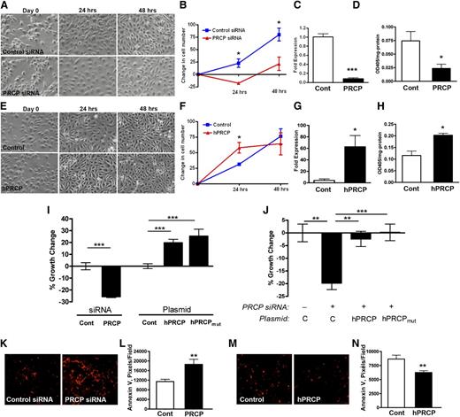 Figure 1. PRCP levels modulate endothelial cell growth. (A) BAEC were transfected with control or PRCP siRNA, and images were taken at time 0 (D0) and at 24 and 48 hours. (B) Graphic data represent mean ± SD changes in cell numbers per field compared with mean D0 values (n = 3 for both groups). (C) Relative bovine PRCP mRNA expression after siRNA transfections (Cont vs PRCP) on quantitative PCR (n = 5 for both groups). (D) Relative PK activation by expressed bovine PRCP as determined by OD405 nm/mg protein of cells (n = 3 for both groups). (E) BAEC were transfected with Control (vector) or hPRCP (plasmid expressing the full length mature human PRCP), and images were taken at time 0 (D0) and at 24 and 48 hours. (F) Graphic data represent mean ± SD changes in cell numbers per field compared with mean D0 values (n = 3 for both groups). (G) Relative human PRCP mRNA expression after vector (Cont) or hPRCP transfection on quantitative PCR (n = 5 for both groups). (H) Relative PK activation by expressed PRCP after hPRCP transfection as determined by OD405 nm/mg protein of cells (n = 9 in both groups). (I) The % growth change of BAEC after siRNA (Cont or PRCP) or plasmid (Cont, hPRCP, hPRCPmut) transfections as measured by a MTS cell assay (n ≥ 5 for all groups). (J) The % growth change of BAEC transfected with PRCP siRNA (+) (n = 9) without (C) or with hPRCP (n = 15) or hPRCPmut plasmid (n = 15). (K) Alexa-594–labeled Annexin V expression on BAEC after Control and PRCP siRNA transfection. (L) The relative Annexin V expression (pixels/field) on BAEC after Control and PRCP siRNA transfection from (K) (n ≥ 12 for both groups). (M) Alexa-594–labeled Annexin V expression on BAEC after Control and hPRCP transfection. (N) The relative pixels/field of Annexin V expression on BAEC after Control and hPRCP transfection from (M) (n > 12 for both groups). All images were obtained using a Nikon TE200 microscope with a 10×/0.25 objective lens. The figures are expressed as mean ± SEM unless otherwise stated. *P < .05, **P < .01, ***P < .001 of comparisons between 2 groups.