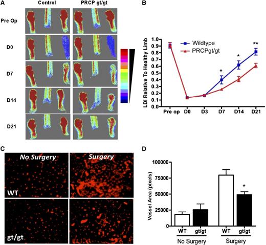 Figure 4. PRCP influences limb ischemia recovery. (A) LDI was performed on hind limbs and feet from WT and PRCPgt/gt mice (n = 10 for both groups) before and after ligation of the femoral artery on D0, D7, D14, and D21. The figure is a representative study. The scale of color from red to blue on the right represents the intensity of heat from strong to little. (B) LDI densities of the blood flow in injured limbs were compared with the uninjured limbs for each genotype on each day. On 2-way analysis of variance, the differences between the 2 recovery curves were highly significant (P < .0001). (C) Frozen sections from gastrocnemius muscles were stained with a PECAM (CD31) antibody from uninjured and ischemic limbs after the ligated vessel was excised and removed (n = 4 for both groups) 28 days after injury. Images were obtained using a Nikon TE200 microscope 20×/0.45. (D) CD31-positive vessel area in pixels was determined by morphometric analysis in each of the control or treatment groups. *P < .05, **P < .01 for specific comparison between groups.
