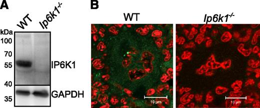 Figure 1. IP6K1 is expressed in platelets and megakaryocytes. (A) Western blot analysis of lysates prepared from WT and Ip6k1−/− platelets pooled from 3 mice of each genotype, using an antibody against IP6K1. GAPDH was used as a loading control. The blot is representative of 3 independent experiments. (B) Immunohistofluorescence analysis of IP6K1 expression (green) in femur bone marrow sections. Nuclei are counterstained with propidium iodide (red). Images were acquired by confocal microscopy (LSM 510 META; Carl Zeiss) using a 63×/1.4NA objective (Carl Zeiss). To improve visualization of IP6K1 staining (green), images were subjected to a 10% linear increase in brightness using LSM Browser (Carl Zeiss), and nonlinear adjustment of contrast and tonal range using Adobe Photoshop (level adjustment). Scale bars represent 10 µm.