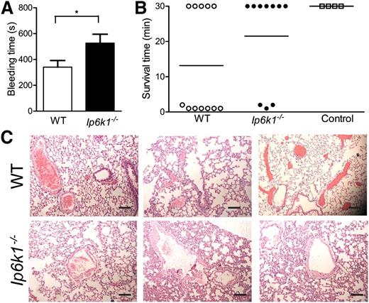 Figure 6. Altered hemostasis in Ip6k1−/− mice. (A) Bleeding time was measured following tail tip amputation in WT and Ip6k1−/− mice. Data are mean ± standard error (n = 11; *P ≤ .05). (B) Scatter plot indicating survival time of WT and Ip6k1−/− mice challenged with ADP to induce pulmonary thromboembolism. “Control” indicates WT mice injected with sterile water as a vehicle control. Animals that were alive 30 minutes after the challenge were considered survivors. (C) Hematoxylin and eosin–stained sections of lungs of WT and Ip6k1−/− mice that survived the challenge with ADP. Representative images from 3 different mice of each genotype are shown. Scale bars represent 100 µm.
