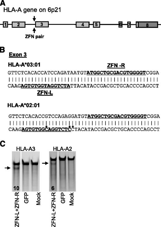 Figure 1. Designed ZFNs disrupt HLA-A expression on HEK293. (A) Schematic of the HLA-A genetic loci. Arrows indicate the location of the putative ZFN binding sites. (B) ZFN binding sites within the HLA-A alleles expressed by HEK293. A 46-base pair segment of the HLA-A*03:01 and HLA-A*02:01 alleles is shown, with bold and underlined nucleotides highlighting the anticipated binding sites for the ZFN-L and ZFN-R monomers, respectively. Cleavage occurs in the region between these sites. Note that HLA-A*02:01 differs from and HLA-A*03:01 at 3 positions within this region, which are marked with an asterisk. ZFN-L was designed to ignore these polymorphisms and to cleave both alleles. (C) Levels of HLA-A3 and HLA-A2 genetic disruption assessed by the Surveyor nuclease assay. The lower (fast-moving) bands (arrows) are digestion products indicating ZFN-mediated gene modification. The numbers indicate the percentage of modified HLA-A alleles based on densitometry. GFP represents genetically modified HEK293 expressing GFP as a control. Mock represents no DNA used.