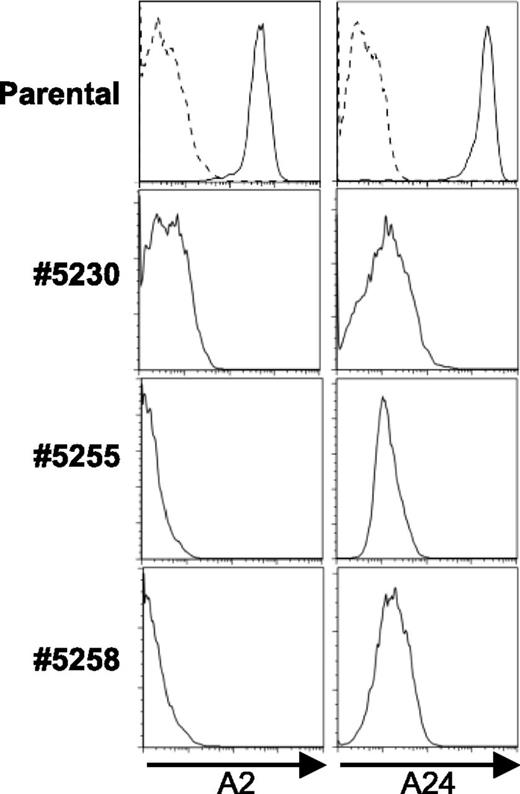 Figure 6. ZFN-mediated elimination of HLA-A expression on human ESC. The HLA-A2+HLA-24+hES parental cell line WIBR3 was modified by ZFN and donor plasmid coding for antibiotic resistance. Clones (5230, 5255, 5258) were chosen with loss of HLA-A expression and differentiated into fibroblasts. Expression of HLA-A2 and HLA-A24 on derived fibroblasts was assessed by flow cytometry after culturing with 600 IU/mL IFN-γ and 10 ng/mL TNF-α for 48 hours. Dashed line in parental panel represents isotype control.