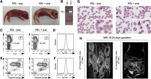 Figure 2. A subset of pups born to multiparous wild-type females mated with KEL males are stillborn or pale. (A) Photograph of a representative pink KEL-negative and pale KEL-positive pup, hours after birth to a multiparous (third litter) wild-type female mated with a KEL male. (B) Representative KEL-specific PCR. (C) Flow cytometric analysis of the blood of the pups shown, with 1000 Trucount beads and RBCs gated. (D) TER119 positivity of gated RBCs. (E) Thiazole orange reticulocyte staining and (F) TER119 staining of the blood of the same pups. (G) Blood smear of representative KEL-negative and KEL-positive pups. (H) MRI of first (left) or third (right) pregnancies of representative wild-type females bred with KEL males.