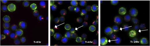 Figure 2. Internalization and trafficking of SGN-CD33A. HNT-34 cells were labeled with SGN-CD33A and incubated for up to 24 hours at 37°C. At the indicated times, cells were fixed, permeabilized, and SGN-CD33A visualized using a fluorescently labeled secondary antibody (green). To study cellular localization of SGN-CD33A, cells were also stained with anti-Lamp1 antibody (red) and DAPI (blue) to mark lysosomes and nuclei, respectively. Arrows indicate examples of colocalized signal (yellow) observed in the merged images. Magnification, 630×, oil immersion.