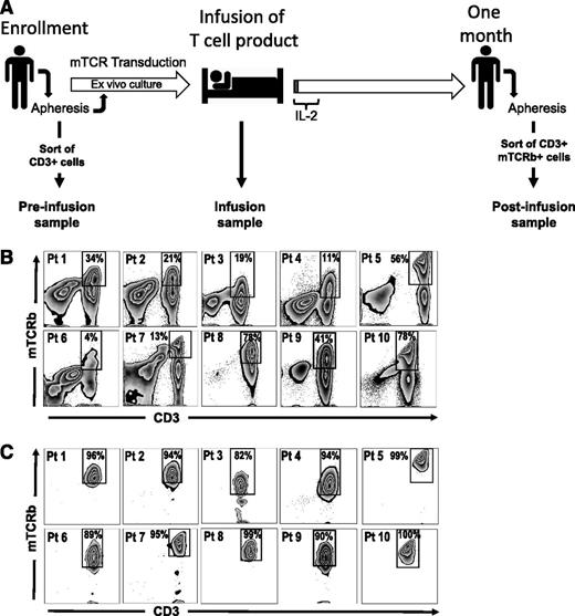 Figure 1. Isolation of TCR-engineered lymphocytes from peripheral blood. (A) Timeline representing the outline of TCR-transfer clinical protocols and the experimental design for the isolation of cells used in gene-expression analysis. PBMCs are isolated ∼24 days before infusion by apheresis and subsequently stimulated with OKT3 in presence of IL-2 (Stim1). Retroviral transductions take place 23 and 22 days before infusion and a REP is started 2 weeks before administration of the cells. Culture media are supplemented with IL-2 during the ex vivo culture. The resulting cellular product is administered on day 0, and IL-2 is given for the first few days (1-3 days) to support engraftment. Approximately 1 month after infusion PBMCs are isolated by apheresis. Samples included in this study were prepared as follows: preinfusion samples are CD3+ cells isolated by negative selection, using magnetic bead sorting, from PBMCs collected at ∼day −24. Infusion samples are aliquots of the final cellular product, isolated from the infusion bag. Postinfusion samples are CD3+ mTCRb+ cells isolated from PBMC samples 1 month after infusion by FACS sorting. (B-C) FACS sorting of engineered T cells from PBMCs at 1 month postinfusion. (B) Presort staining of CD3 and mTCRb. (C) Postsort analysis showing enrichment of T cells expressing murine TCRs. Gated on lymphoid, single, PI− cells.