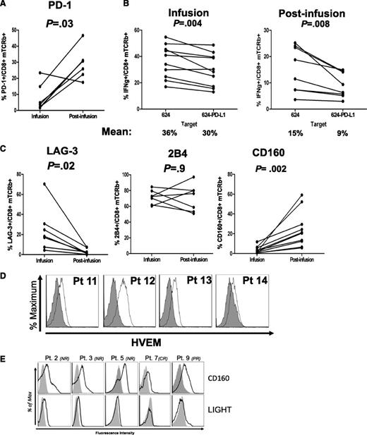 Figure 4. PD-1 and CD160 are overexpressed in persisting transgenic lymphocytes. (A) Percentages of PD-1 expression in infusion and postinfusion CD8 T cells. (B) Reduced IFNγ production in CD8 T cells cocultured in vitro with relevant targets engineered to expressed PD-L1. (C) LAG-3, 2B4, and CD160 exhaustion markers surface expression in CD3+CD8+mTCRb+ infusion and postinfusion lymphocytes. Cells wre gated on lymphoid, PI−, CD3+, CD8+, mTCRb+ cells. (D) HVEM surface expression in melanoma tumor cells present in tumor digests of 4 melanoma patients. (E) Histograms showing surface staining of CD160 and costimulatory receptor LIGHT in persisting engineered lymphocytes of 5 patients. In all samples analyzed, LIGHT expression was lower than that of CD160.