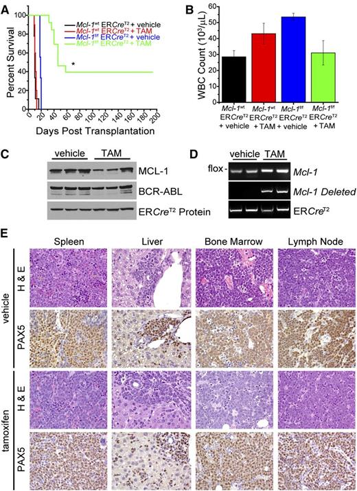 Figure 5. Requirement for MCL-1 during in vivo BCR-ABL leukemia maintenance. (A) Mcl-1f/f Rosa-ERCreT2 (Arfwt) or Mcl-1wt Rosa-ERCreT2 BM was transduced with p185-IRES-GFP and transplanted into lethally irradiated (1100 rad) C57BL/6 recipients that were monitored for leukemia initiation. After leukemia initiation, BM from the leukemic mice (2 independent leukemia donors per genotype) was harvested and mixed 1:1 with control CD45.1 congenic BM and transplanted into secondary, lethally irradiated (1100 rad) C57BL/6 recipients (∼10 secondary recipients each for 2 separate leukemic donors). After 5 days, the secondary recipients were treated with 5 daily doses of TAM (1 µg/d) to activate Cre (n = 13 mice for Mcl-1f/f Rosa-ERCreT2 and n = 10 for Mcl-1wt Rosa-ERCreT2 donors) or control vehicle (n = 9 mice for Mcl-1f/f Rosa-ERCreT2 and n = 9 for Mcl-1wt Rosa-ERCreT2 donors) by gavage. Mice were monitored daily and euthanized when moribund. Asterisk (*) denotes P < .001 by log-rank test. (B) White blood cell (WBC) counts were taken from moribund, secondary recipients described in panel A at the time of being euthanized. Bars indicate the averages (n = 6 mice for TAM-treated Mcl-1f/f Rosa-ERCreT2 donors, n = 9 for TAM-treated Mcl-1wt Rosa-ERCreT2 donors, n = 9 mice for vehicle-treated Mcl-1f/f Rosa-ERCreT2 donors, and n = 9 for vehicle-treated Mcl-1wt Rosa-ERCreT2 donors), and error bars indicate SEM. (C) Representative immunoblot shown of GFP+ BM isolated from TAM-treated, moribund mice that received p185+ Mcl-1f/f Rosa-ERCreT2 leukemic BM (each lane represents a recipient mouse). Lysates were blotted for MCL-1, BCR-ABL (as detected by anti-ABL antibody), and ERCreT2 protein as a loading control (note: ERCreT2 fusion protein is present in all cells but is only activated by TAM). (D) Representative Mcl-1, Mcl-1–deleted, and Cre genotyping of GFP+ BM isolated from TAM-treated, moribund mice that received p185+ Mcl-1f/f Rosa-ERCreT2 leukemic BM (each lane represents a recipient mouse). (E) Histopathological examination of moribund vehicle-treated or TAM-treated mice that received p185+ Mcl-1f/f Rosa-ERCreT2 leukemic BM. Images of indicated tissues (×50 magnification) are representative of 9 vehicle-treated mice and 4 moribund, TAM-treated mice analyzed. Hematoxylin and eosin (H&E) and PAX5 immunohistochemistry are morphologically and immunophenotypically indicative of B-lineage leukemia.