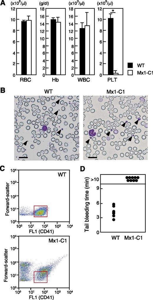 Figure 2. Blood parameters in WT and pIpC-treated Mx1-C1 mice. (A) Red blood cells (RBC), hemoglobin (Hb), white blood cells (WBC) and platelets (PLT). The results represent the median values from 5 WT vs 5 Mx1-C1 males. *P < .01. (B) May-Grünwald Giemsa stain of peripheral blood smears from WT and Mx1-C1 mice. Representative platelets are indicated by arrowheads. Scale bars, 20 μm. (C) Dot plots of forward-light scattering vs FL1 (FITC–anti-CD41) profiles of PRP display of the entire population of platelet sizes in WT and Mx1-C1 mice. Insert boxes (red) indicate the CD41+ population of WT platelets. (D) Prolonged bleeding time in Mx1-C1 mice. Tail bleeding times of WT (n = 6) and Mx1-C1 (n = 9) mice were monitored visually.