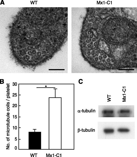 Figure 6. Platelets from Mx1-C1 mice exhibit an abnormal microtubule ultrastructure. (A) Electron micrographs of portions of individual WT and Mx1-C1 platelets. Scale bars, 100 nm. (B) Quantification of the number of microtubule coils. Data were obtained from 8 WT and Mx1-C1 platelets each and presented as means ± SEM. *P < .01. (C) Western blot analysis of platelet extract with anti–α-tubulin and anti–β-tubulin Abs.
