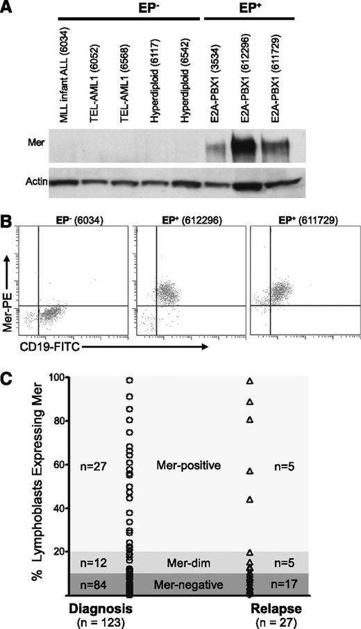 Figure 1. Mer is expressed in diagnostic samples derived from patients with B-ALL. Twenty-eight diagnostic bone marrow samples from patients with B-cell ALL were analyzed by (A) immunoblot and/or (B) flow cytometry for the expression of Mer protein. (A) Immunoblot analysis of Mer protein (∼180 kDa) in representative samples of non–E2A-PBX1 (EP−) B-ALL (lanes 1-5) and E2A-PBX1+ (EP+) B-ALL (lanes 6-8). Patient sample ID is shown in parentheses for comparison; the complete data set is listed in supplemental Table 1. The membrane was stripped and reprobed with anti-actin (∼43 kDa) antibody to confirm similar loading of total protein. (B) Representative flow cytometry profiles for one EP− B-ALL sample (6034) and two EP+ B-ALL samples (612296 and 611729) are shown. All three samples expressed the CD19 B-lineage marker whereas only the EP+ samples exhibited Mer staining. (C) Mer expression was determined by flow cytometry in a prospective analysis of samples collected at diagnosis or relapse from patients with B-ALL. Each symbol represents data collected from a single sample. Approximately 32% of patients at diagnosis and 37% of patients at relapse express Mer on leukemic blasts (Mer positive + Mer dim).