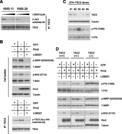 Figure 4. Pim2 regulates mTOR-C1 pathway through modulating TSC2 phosphorylation. (A) Pim inhibition leads to reduced phosphorylation on TSC2 in MM cells. KMS-11 and KMS-26 cells were treated with LGB321 (0, 0.33, and 1.0 μM) for 2 hours; TSC2 was immunoprecipitated and analyzed for phosphorylation status by a specific p-Akt substrate antibody (Ab). (B) Pim2 regulates TSC2 phosphorylation and mTOR-C1 pathway activity. Pim2 was transfected into 293A cells, with green fluorescent protein (GFP) as transfection control. After 48 hours, cells were treated with either dimethylsulfoxide (DMSO) or LGB321 (1.0 μM) for 2 hours. TSC2 phosphorylation status was examined by immunoblotting with p-Akt substrate Ab following IP of TSC2; mTOR-C1 pathway activity was examined by immunoblotting with p-S6RP Ab. (C) TSC2 knockout was generated from 293A cells by ZFN technology. (D) Pim2 failed to modulate mTOR-C1 pathway in the absence of TSC2 in 293A cells. Pim2 was transfected into 293A cells with various TSC2 background (TSC2+/+, TSC2+/−, TSC2−/−) and then treated with either DMSO or LGB321 (1.0 μM) for 2 hours. mTOR-C1 pathway activity was examined by immunoblotting for p-P70S6K (T389) and p-S6RP (S235/236).