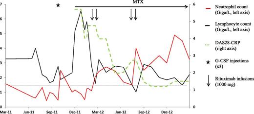 Figure 2. Patient 2, a 63-year-old man diagnosed with T-cell LGLL in July 2011. Seropositive erosive RA was diagnosed in November 2011, and low-dose methotrexate and prednisone were started. Three months later, neither the joint disease nor the leukemia was improved. Two 1000-mg rituximab infusions provided a rapid remission of the joint disease accompanied with immediate neutrophil count normalization despite persistence of the monoclonal T-cell population. Six months later, a second rituximab course was given for exacerbation of the joint symptoms. In January 2013, the RA was still in remission despite prednisone discontinuation, neutrophil counts remained normal, and the leukemic cell count was substantially decreased. DAS28, RA disease activity score evaluating 28 joints; MTX, methotrexate.