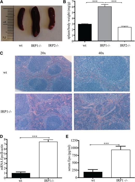 Figure 1. Juvenile IRP41−/− mice present with splenomegaly, extramedullary hematopoiesis, and increased Epo expression. WT, IRP1−/−, and IRP2−/− mice (n = 7) were euthanized at the age of 4 to 6 weeks. (A) Spleen size. (B) Spleen to body weight ratios. (C) Hematoxylin and eosin staining of spleen sections; magnifications at (left) 20× and (right) 40×. (D) Epo mRNA expression in the kidneys (n = 5). (E) Serum Epo levels (n = 5). ***P < .001.
