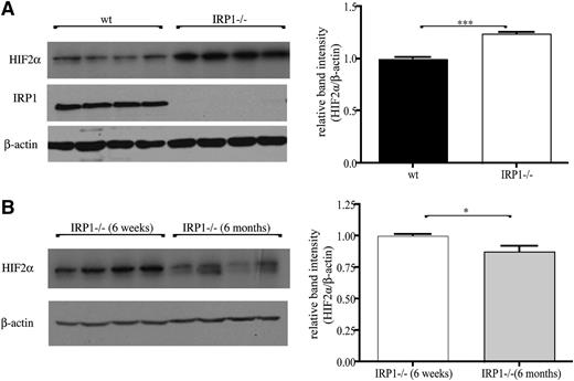 Figure 5. Accumulation of HIF2α protein in the kidneys of IRP1−/− mice is age dependent. (A) (Left) Western blots of IRP1, HIF2α, and β-actin in kidneys of 6-week-old WT and IRP1−/− mice (n = 4). (Right) Densitometric quantification of HIF2α expression. (B) (Left) Comparative western blot and (right) densitometric quantification of HIF2α expression in kidneys of 6-week- and 6-month-old IRP1−/− mice (n = 4). *P < .05; ***P < .001.