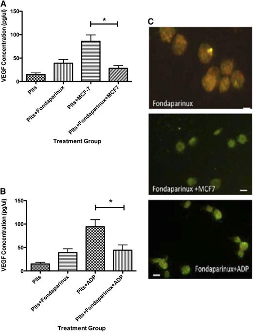 Figure 4. Fondaparinux suppresses VEGF release from human platelets after exposure to MCF-7 cells or ADP. (A) VEGF concentration in the releasate generated from platelets resting or exposed to MCF-7 cells after exposure to fondaparinux. (B) VEGF concentration in the releasate generated from platelets activated with 25 μM ADP after exposure to fondaparinux. (C) Immunofluorescence of platelets resting, exposed to MCF-7 cells, or activated with 25 μM ADP after exposure to fondaparinux and labeled with endostatin (red) or VEGF (green). *P < .05. Bars represent 300 μM.