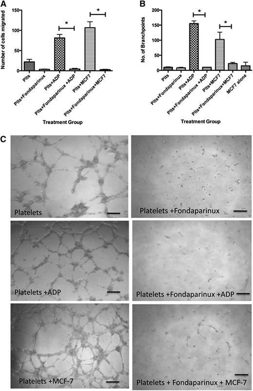 Figure 5. Fondparinux inhibits platelet-mediated angiogenic response. (A) Endothelial cell migration after exposure to the releasate from control, resting platelets (Plts) or platelets activated with 25 μM ADP or stimulation with MCF-7 cells after exposure to fondaparinux. (B) Quantification of branch points generated by the releasate from resting platelets or platelets activated with 25 μM ADP or stimulation with MCF-7 cells after exposure to fondaparinux. (C) Representative images of capillary tube formation generated from the releasate of resting platelets or platelets exposed to ADP or MCF-7 cells with or without fondaparinux. *P < .05. Bars represent 100 μM.