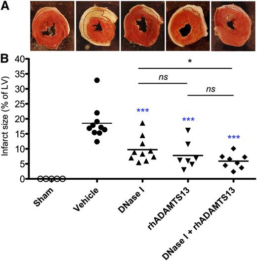 Figure 1. Infarct volumes after LAD occlusion following reperfusion in sham-operated mice, mice treated with vehicle, DNase I, rhADAMTS13, or a combination of DNase I with rhADAMTS13. (A) Representative TTC stains of transverse sections of the LV of the 5 experimental groups. Infarctions appear as white and are outlined with dotted lines. The surrounding white layers represent the pericardium and were not included in the analysis. (B) Myocardial infarct size (expressed as % of LV) measured at 24 hours after LAD occlusion. *P < .05, ***P < .001 (blue asterisks represent comparison with vehicle; black, between treated groups).