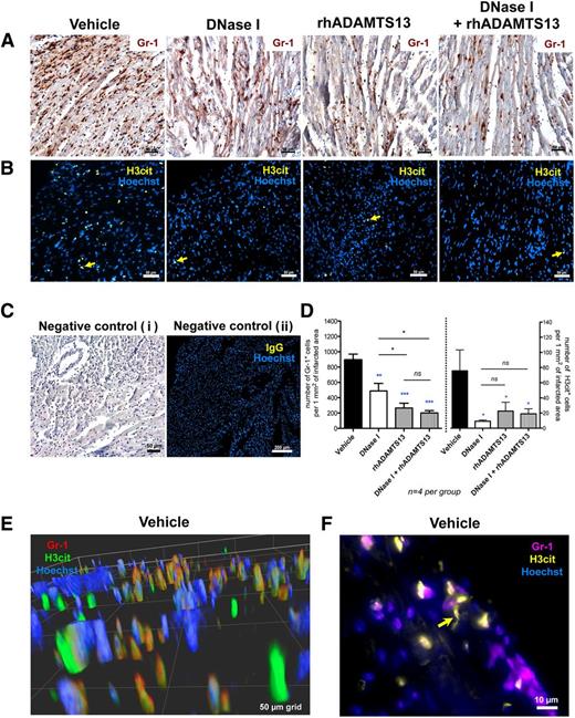 Figure 4. Treatment with DNase I and rhADAMTS13 significantly reduces leukocyte infiltration and H3cit accumulation in the infarcted area. (A) Immunohistochemical staining revealed abundant presence of Gr-1–positive cells (brown) infiltrating the ischemic myocardium in vehicle-treated mice and significantly less in heart sections of mice treated with DNase I monotherapy, rhADAMTS13 monotherapy, or DNase I in combination with rhADAMTS13. (B) Immunofluorescence analysis showed H3cit-positive cells in the infarcted area (yellow arrows). Numerous H3cit-positive cells were found in the vehicle-treated group, whereas only a few H3cit-expressing cells were found after treatment with DNase I, rhADAMTS13, or a combination of DNase I and rhADAMTS13. (C) Incubation with only secondary antibody served as a negative control (i). Negative control was performed using specific IgG instead of primary antibody (ii). (D) Numbers of cells positive for Gr-1 (left) and H3cit (right) were counted (4 mice per group) and presented as positive cells per 1 mm2 of infarcted area, respectively (*P < .05, **P < .01, ***P < .001; blue asterisks represent comparison with vehicle, and black between treated groups). (E) Representative deconvolved 3D image of double staining for Gr-1 (red) and H3cit (green) of the infarcted myocardium in a vehicle-treated mouse. Most H3cit-positive cells are associated with Gr-1 antigen. (F) Double immunofluorescence analysis for Gr-1 (purple) and H3cit (yellow). Yellow arrow indicates NET-like H3cit-positive structure. Scale bars: 50 μm (A-B, Ci), 200 μm (Cii), 50-μm grid (E), 10 μm (F).