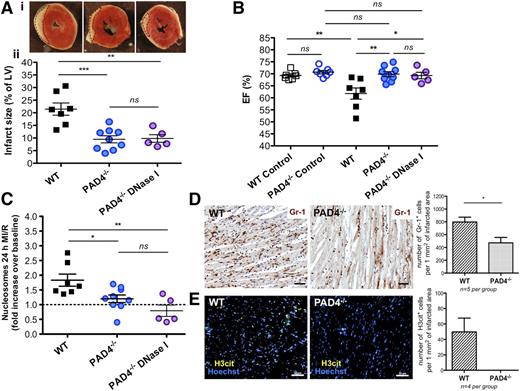 Figure 5. PAD4−/− mice are protected from MI/R injury and their protection is not enhanced by DNase I treatment. (A) (i) Representative TTC stains of transverse sections of the LV 24 hours after MI/R of WT (left), PAD4−/− mice nontreated with DNase I (middle), and after DNase I infusion (right). Infarcted areas appear as white and are outlined with dotted lines. (ii) Myocardial infarction size in the studied groups (measured as % of LV), established at 24 hours after LAD occlusion (**P < .01, ***P < .001). A portion of PAD4−/− mice were treated with buffer as a control for DNase I infusion, but because we did not see a difference between buffer-treated and nontreated PAD4−/− mice, the PAD4−/− data were combined (blue solid circle). (B) No difference was observed in LV ejection function between healthy (control) WT and control PAD4−/− mice (blue open circle). Echocardiography analysis performed after 24-hour MI/R revealed a significantly higher EF (%) in PAD4−/− mice nontreated with DNase I (blue solid circle) as compared with WT group (**P < .01). DNase I infusion to PAD4−/− mice (purple circle) did not ameliorate cardiac function as compared with non-DNase I–treated PAD4−/− mice. (C) The level of circulating nucleosomes (fold increase over the baseline) remained unchanged both in PAD4−/− mice with or without DNase I treatment 24 hours after ischemia onset and was significantly lower as compared with WT mice (*P < .05, **P < .01). (D) Representative Gr-1 immunohistochemical staining of ischemic areas in WT and PAD4−/− mice. PAD4−/− mice showed significantly fewer Gr-1–positive cells infiltrating the infarcted myocardium than WT (*P < .05). (E) Immunofluorescence analysis revealed H3cit-positive cells in WT mice, whereas none were found in the PAD4−/− mice. Scale bars, 50 μm (D-E).