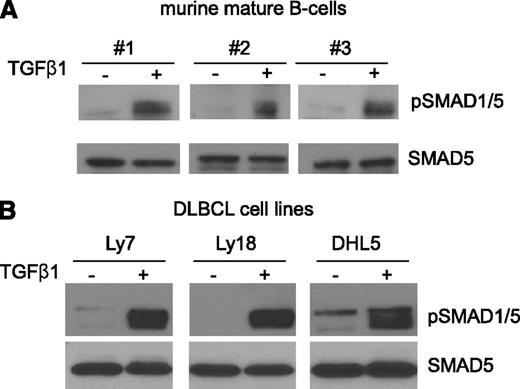 Figure 1. TGF-β1 phosphorylates SMAD5 in normal and malignant mature B cells. (A) Mature B cells were purified from the spleens of 3 WT C57BL/6 mice and exposed to TGF-β1 (5 ng/mL) or vehicle control for 4 hours. Western blot analysis demonstrates prompt induction of SMAD1/5 phosphorylation in these cells. (B) TGF-β1 (5 ng/mL, 1 hour) also induced marked activation of SMAD1/5 in DLBCL cell lines. In both instances, the western blotting was carried out with nuclear extracts. Equal loading is verified with immunoblotting to total SMAD5. The assays shown in panel A represent 3 biological replicates (B cells from 3 mice), and the assays shown in panel B were confirmed in multiple (more than 3) biological replicates.