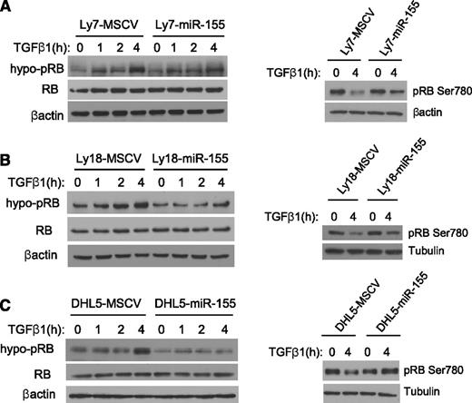 Figure 3. miR-155 impairs TGF-β1–mediated RB activation in DLBCL. Western blot analysis of hypo-pRB (left panels) or phospho-Ser780 residue (right panels) was performed in the DLBCL cell lines Ly7 (A), Ly18 (B), and DHL5 (C), genetically modified to express an empty vector (MSCV) or miR-155. Upon TGF-β1 exposure (5 ng/mL), an increase in the abundance of hypo-pRB (active RB) is detected in the MSCV-expressing cell lines and, to a much lesser degree, in their isogenic counterparts expressing miR-155 (left panels). In agreement with this observation, the phosphorylation levels of RB’s Ser780 residue was markedly suppressed by TGF-β1 in MSCV-expressing cells, but not in their isogenic miR-155 counterparts (right panels). Immunoblotting for total RB confirms that miR-155 does not modify its expression level, and equal loading is also verified with β-actin or tubulin. The data shown in this figure were confirmed in 2 to 4 biological replicates.