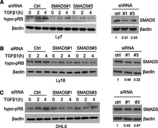 Figure 4. SMAD5 KD phenocopies miR-155 effects on TGF-β1-mediated RB phosphorylation. Western blot analysis of hypo-pRB (left panels) was performed in the DLBCL cell lines Ly7 (A), Ly18 (B), and DHL5 (C) subjected to RNAi-mediated SMAD5 suppression. Upon TGF-β1 exposure (5 ng/mL), the abundance of the hypo-pRB (active RB) isoform increases in the control RNAi cells, but not, or to a lesser degree, in their isogenic counterparts transiently (Ly18 and DHL5) or stably (Ly7) expressing 2 independent RNAi sequences directed at SMAD5 (left panels). In the right panels, western blots depict the effectiveness of the SMAD5 KD; densitometric quantification of the SMAD5 suppression is shown under each panel. β-actin imunoblotting was used to confirm proper loading. The data shown in this figure were confirmed in 2 to 4 biological replicates.