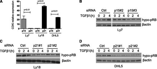 Figure 5. p15 and p21 inhibition recapitulates miR-155 suppression of TGF-β1 signals in DLBCL. (A) Real-time RT-PCR quantification of P15 and P21 in 3 DLBCL cell lines shows a dominant expression of P15 in Ly7 and P21 in Ly18 and DHL5 (P < .01, Student t test). (B) Western blot analysis of hypo-pRB was performed in the DLBCL cell line Ly7 transiently expressing an siRNA control or 2 sequences specific for p15. Upon TGF-β1 exposure (5 ng/mL), the abundance of the hypo-pRB (active RB) isoform increases in the control siRNA Ly7 cells, but not in their p15 KD isogenic counterparts. (C-D) Western blot analyses of hypo-pRB were performed in the DLBCL cell lines Ly18 and DHL5 transiently expressing an siRNA control or 2 sequences specific for p21. Upon TGF-β1 exposure (5 ng/mL), the abundance of the hypo-pRB (active RB) isoform increases in the control siRNA cells, but not, or to a lesser extent, in p21 KD cells. The effectiveness of the siRNA-mediated p15 and p21 suppression is shown in supplemental Figure 7. β-actin imunoblotting was used to confirm proper loading. The data shown in this figure were confirmed in 1 to 3 biological replicates.