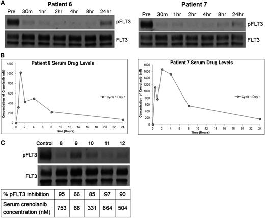 Figure 5. Crenolanib inhibits FLT3 in vivo. (A) Plasma samples from patients 6 and 7 were collected as part of the phase 2 clinical trial of crenolanib. Patients received a single dose of drug on day 1, and samples were collected for PIA and pK analysis. Molm14 cells were incubated with each plasma sample for 1 hour and then lysed, immunoprecipitated for FLT3, and analyzed by immunoblot for phospho- and total FLT3. (B) The same time course samples from these patients were analyzed by mass spectroscopy for serum drug concentrations of crenolanib. (C) Blasts from patient 4 (relapsed D835V) were used for a PIA assay with steady-state plasma samples from 5 different patients enrolled in the crenolanib trial. Blasts were incubated in plasma for 1 hour and then lysed, immunoprecipitated for FLT3, and analyzed by immunoblot for phospho- and total FLT3. Densitometry was performed on this blot and serum concentrations of crenolanib from the corresponding time points were determined by pK analysis. In the figure, the densitometry result (expressed as a percentage of control) and the crenolanib concentration for a given time point are listed directly below each sample on the blot.