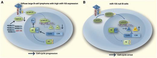 The TGF-β1–pRB axis in distinct miR-155 contexts. Outcome of the TGF-β1 activation of SMAD5 in DLBCL (A), which often expresses high levels of miR-155. In these malignant cells, miR-155 will markedly suppress SMAD5 expression, resulting in defective p15/p21 transcriptional induction and limited inhibition of the cyclin-dependent kinase (CDK)–cyclin complex–mediated phosphorylation of RB. The resulting hyperphosphorylated (inactive) RB allows tumor cells to progress through the cell cycle irrespective of prohibitive extracellular TGF-β signals instructing G0/G1 arrest. Mature B cells lacking miR-155 (B). In this instance, elevated SMAD5 expression sensitizes the cells to TGF-β1–mediated induction of p15/p21. The high expression of these CDK inhibitors blocks the CDK–cyclin complex and the hypophosphorylated (active) RB promotes cell-cycle arrest. This scenario may explain the defective germinal center B-cell development found in miR-155 null mice. In this diagram, stimulatory interactions are indicated with →; inhibitory interactions with ⊥. Professional illustration by Marie Dauenheimer.