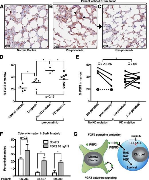 Figure 5. FGF2 is increased in the bone marrow of patients without KD mutations and decreases with ponatinib treatment. Bone marrow core biopsies obtained from normal controls (surgical joint replacement patients), CML patients at diagnosis, tyrosine kinase inhibitor resistant patients before ponatinib therapy (pre-ponatinib), and responsive patients post-ponatinib were collected and evaluated for FGF2 by IHC as described in “Methods.” Representative images of (A) normal control, (B) pre-ponatinib marrow of a patient without KD mutation, and (C) the same patient post-ponatinib. FGF2 is normally expressed in marrow stroma (A); arrows indicate nonstromal areas of increased FGF2 in resistant patients (B). (D) IHC images from normal controls, patients at diagnosis, and pre-ponatinib patients who responded to ponatinib (with and without KD mutations) were analyzed with Aperio ImageScope software to quantify FGF2 staining. The line indicates the median value. Statistically significant differences were evaluated using a 2-tailed Student t test. (E) Paired IHC analysis of pre- and post-ponatinib bone marrow of patients treated with ponatinib (same as D). Patients without KD mutations had an average decrease of 15.9% in FGF2 staining, whereas patients with KD mutations were more variable. The differences pre- and post-ponatinib were analyzed by the 2-tailed Student t test for significance. A single patient without KD mutations who failed IM, DAS, NIL, and ponatinib is plotted with a dotted line for comparison (see Table 1). (F) CD34+ cells from newly diagnosed CML patients were resuspended in methocult H4534 ± FGF2 10 ng/mL and ± 5 μM IM. Cells were plated in triplicate, cultured for 14 days, and then CFU-GM colonies were counted. The data are presented as the percent of untreated control (control or FGF2). The differences between control and FGF2 were analyzed by 2-tailed Student t test for significance. *P < .05. (G) Model of FGF2 paracrine protection of CML cells based upon data in this article and previous publications regarding FGF2 autocrine/paracrine stromal cell signaling.44,45