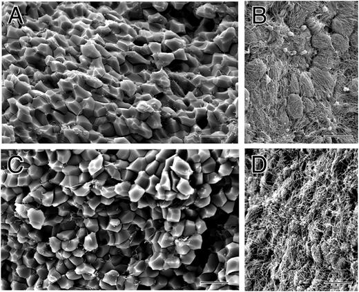 Figure 1. The structure of contracted human whole blood clots. Scanning electron micrographs of whole-blood clots activated by thrombin following recalcification. (A,C) Inside of contracted clots, revealing close-packed polyhedra. (B,D) Outside of contracted clots, showing a thick meshwork of fibrin and platelet aggregates. Magnification bar = 10 µm.