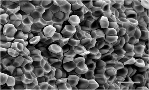 Figure 2. The structure of erythrocytes from centrifuged unclotted human blood. Scanning electron micrograph showing the shape change of erythrocytes as a result of the forces of centrifugation at 6000g. Polyhedrocytes were observed with centrifugation of blood at forces of 1000g or greater, but not at lower forces. From the weight of a single erythrocyte of ∼1 pN or 10−7 dyn force applied to half of its surface area, the minimal stress required to induce polyhedrocyte formation and tight packing is estimated to be ∼75 to 150 dyn/cm2, well within the range of stress generated by platelets during contraction. Magnification bar = 10 µm.