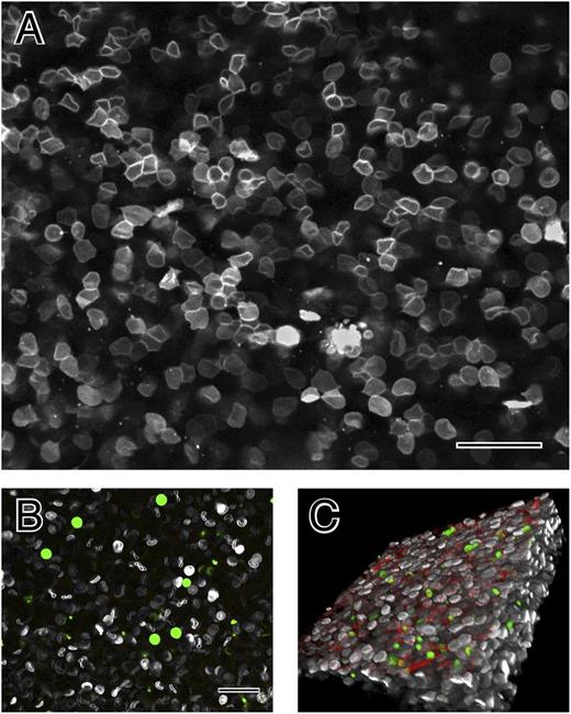 Figure 3. The structure of contracted human whole blood clots by confocal light microscopy. (A) Confocal light micrograph of contracted whole-blood clot activated by thrombin following recalcification. Erythrocyte membranes of 30% of cells were fluorescently labeled with DiD. (B) Whole blood before clotting. Leukocytes and platelets were labeled with calcein (green); larger cells are leukocytes and smaller ones are platelets. Fibrinogen was labeled with Alexa 564 but is not visible, because it is not polymerized. (C) Three-dimensional reconstruction of contracted whole-blood clot. The outside of the clot is on the top, where there are platelets (green), fibrin (red), and biconcave erythrocytes (white). Erythrocytes deeper in the clot are polyhedral. Magnification bar = 25 µm.