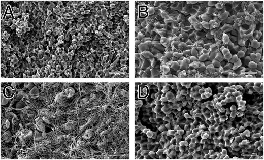 Figure 4. The structure of clots made from reconstituted human whole blood activated with kaolin and mouse whole blood. (A-C) Scanning electron micrographs of clots made from reconstituted human whole blood consisting of 2 mg/mL fibrinogen, 167 000 platelets/μL, 37% hematocrit, activated by kaolin following recalcification. (A-B) Inside of these contracted clots, revealing close-packed polyhedra. (C) Outside of contracted clot, showing a thick meshwork of fibrin and platelet aggregates. (D) Scanning electron micrograph of the inside of a mouse whole-blood clot. Magnification bar = 20 µm (A) and 10 µm (B-D).
