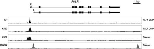 Figure 4. Binding of KLF1 to the PKLR gene. (top) a representation of the PKLR gene structure including the start of the erythroid (E)-specific transcript (dark gray) and the liver (L)-specific first exon in light gray. (bottom) KLF1 binding and DNase I hypersensitive sites in cultured human erythroid progenitors (EP), K562; erythroleukemia cell line, HepG2; and liver cells line, as indicated.