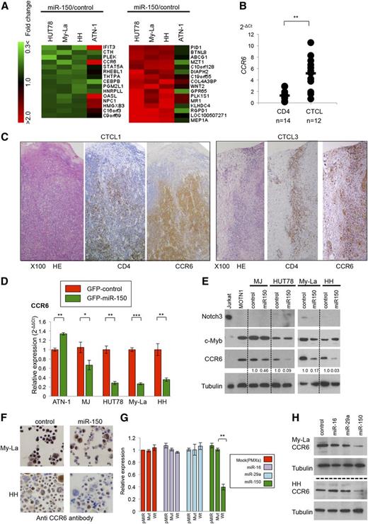Figure 4. CCR6 is a potential target of miR-150 in CTCL cells. (A) Detection of potential miR-150 target genes in GFP-miR-150 or GFP-empty (control) transduced CTCL cell lines. Left (downregulation): heat map of genes showing a GFP-miR-150 (shown as “miR-150”)/GFP-empty (shown as “control”) ratio <0.75. Right (upregulation): genes showing miR-150/control ratio >1.3. (B) CCR6 expression of normal CD4+ T cells (n = 14), CTCLs (10 cases of advanced MF and 2 cases of SzS). P values were calculated using the Mann-Whitney U test. Asterisks (*) indicate statistical significance: **.001 ≤ P < .01. (C) Immunohistochemistry of CCR6, CD4, and HE in primary CTCL (CTCL1 and CTCL3). (D) Taqman PCR analysis of CCR6 in the cells transfected with GFP-miR-150 or GFP-control. Y-axis: relative expression of CCR6 adjusted in GFP-transfected cells (2−ΔΔCt). P values were calculated using Student t test. Asterisks (*) indicate statistical significance: *.01 ≤ P < .05; **.001 ≤ P < .01; ***P < .001. Bars are means ± SEM of 3 independent experiments. (E) Western blot analysis of Notch 3, c-Myb, CCR6, and tubulin in indicated transfected cell lines. Fold changes in CCR6 levels are shown below the gels. Control: GFP-empty (shown as “control”) transduced cells; miR-150: GFP-miR-150 transduced cells. Tubulin served as a control of western blot analysis. (F) Immunohistochemistry of CCR6 in My-La and HH cells transfected with or GFP-empty control (shown as “control”) or GFP-miR-150 (shown as “miR-150”). (G) Luciferase reporter assays showing CCR6 expression in Rat-1 fibroblasts transfected with miR-16-1, miR-29a, miR-150, or PMXs-puro control vector. Blots showing miR-150 expression are beside the bars: pMIR, empty vector (pMIR vector); Mut, CCR6 3′UTR mutation-inserted pMIR vector; and Wt, CCR6 3′UTR wild-type–inserted vector. P values were calculated using Student t test. Asterisks (*) indicate statistical significance: **.001 ≤ P < .01. Bars are means ± SEM of 3 independent experiments. (H) Western blot analysis of CCR6 and tubulin in My-La and HH cells transfected with GFP-control (control), GFP-miR-16-1 (miR-16), GFP-miR-29a (miR-29a), or GFP-miR-150 (miR-150).